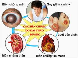 BIẾN CHỨNG CỦA BỆNH ĐÁI THÁO ĐƯỜNG